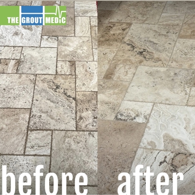 Before & After Photo